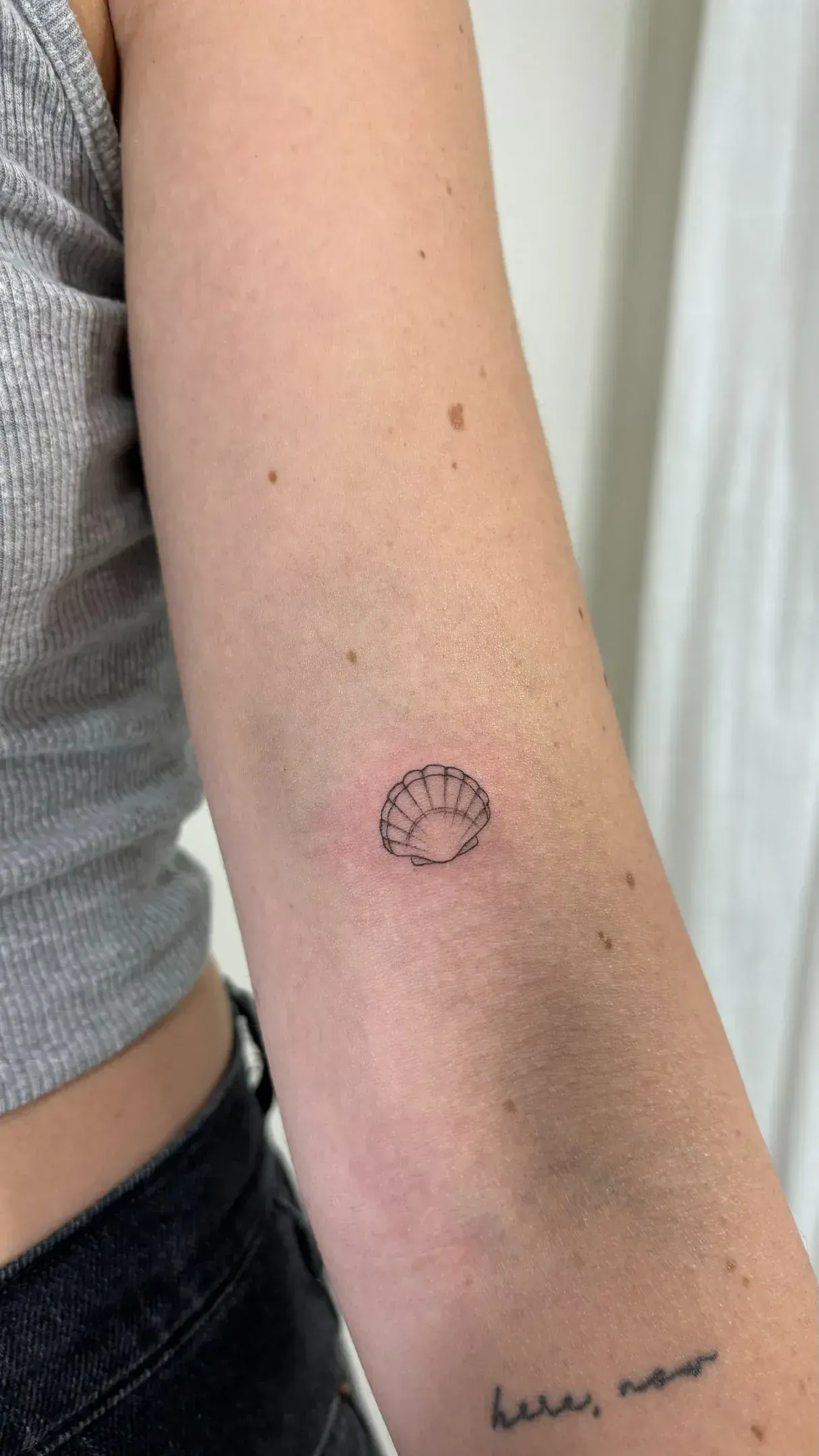 13) Concha de vieira en el antebrazo