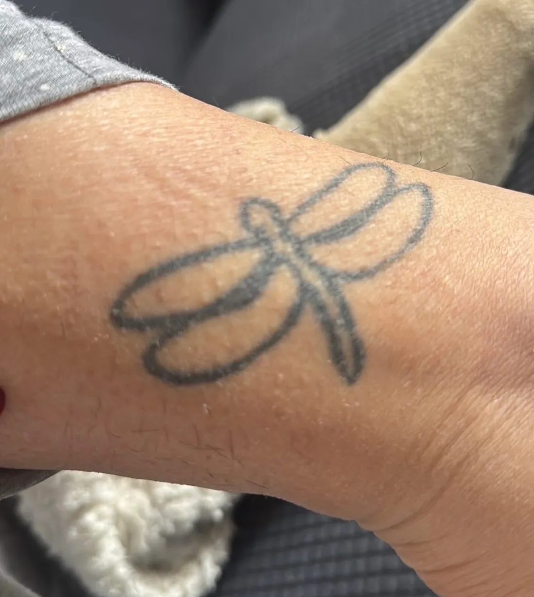 Cover-up de tatuaje en Madrid — antes