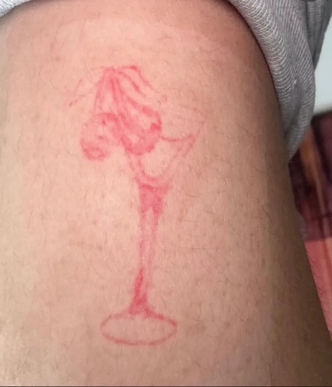 Cover-up de tatuaje en Madrid — antes