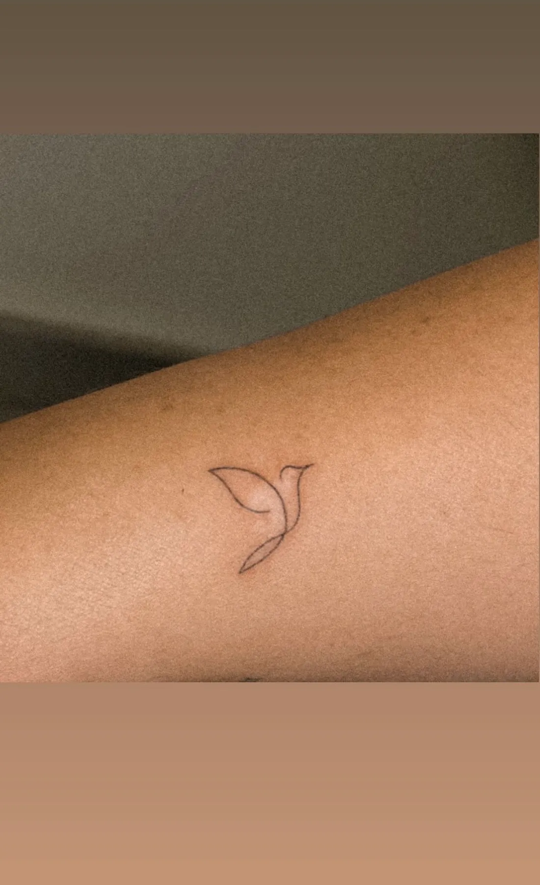 Tatuaje sobre cicatriz — Sinkply Madrid